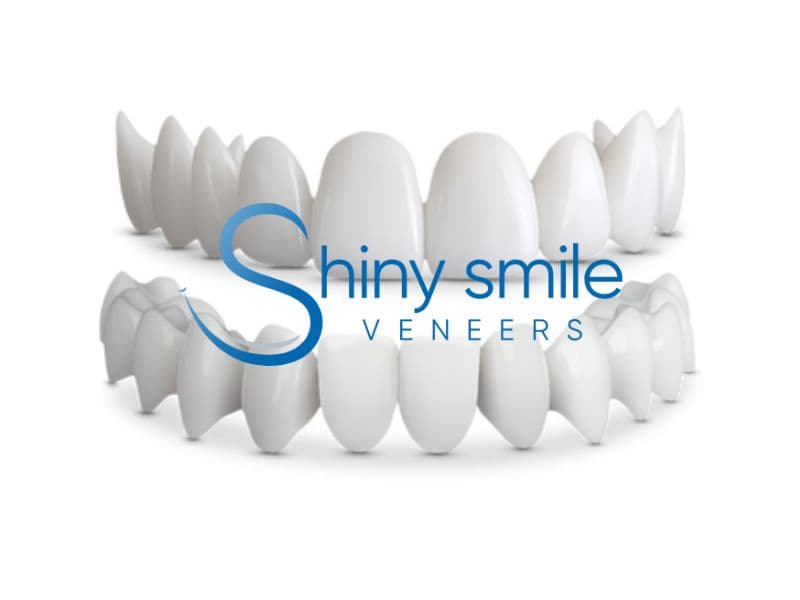 Shiny Smile Veneers Review 2025: Affordable Dentist-Designed Snap-on ...