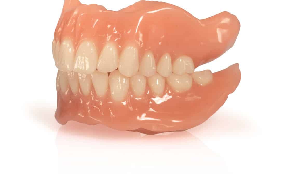Ivoclar BPS Precision Overdenture System