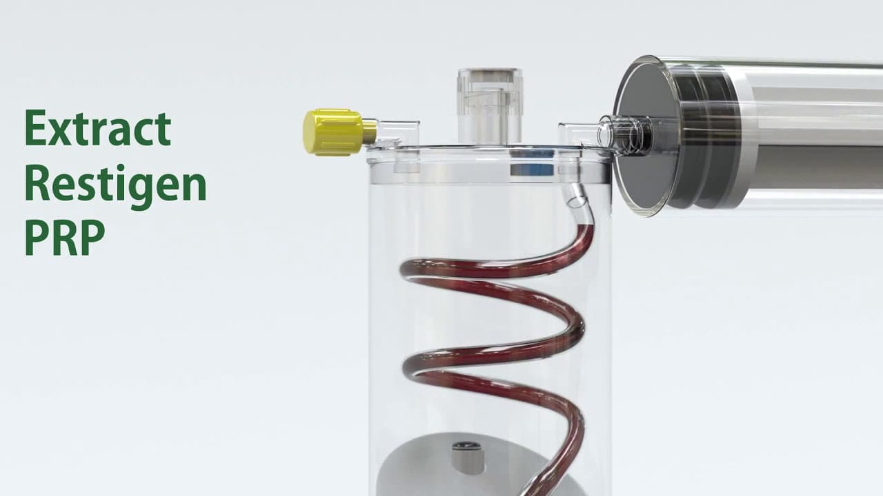 How It Works - Restigen PRP Device - YouTube