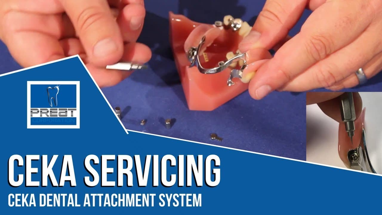 Ceka Preci-Clix Overdenture Attachment System