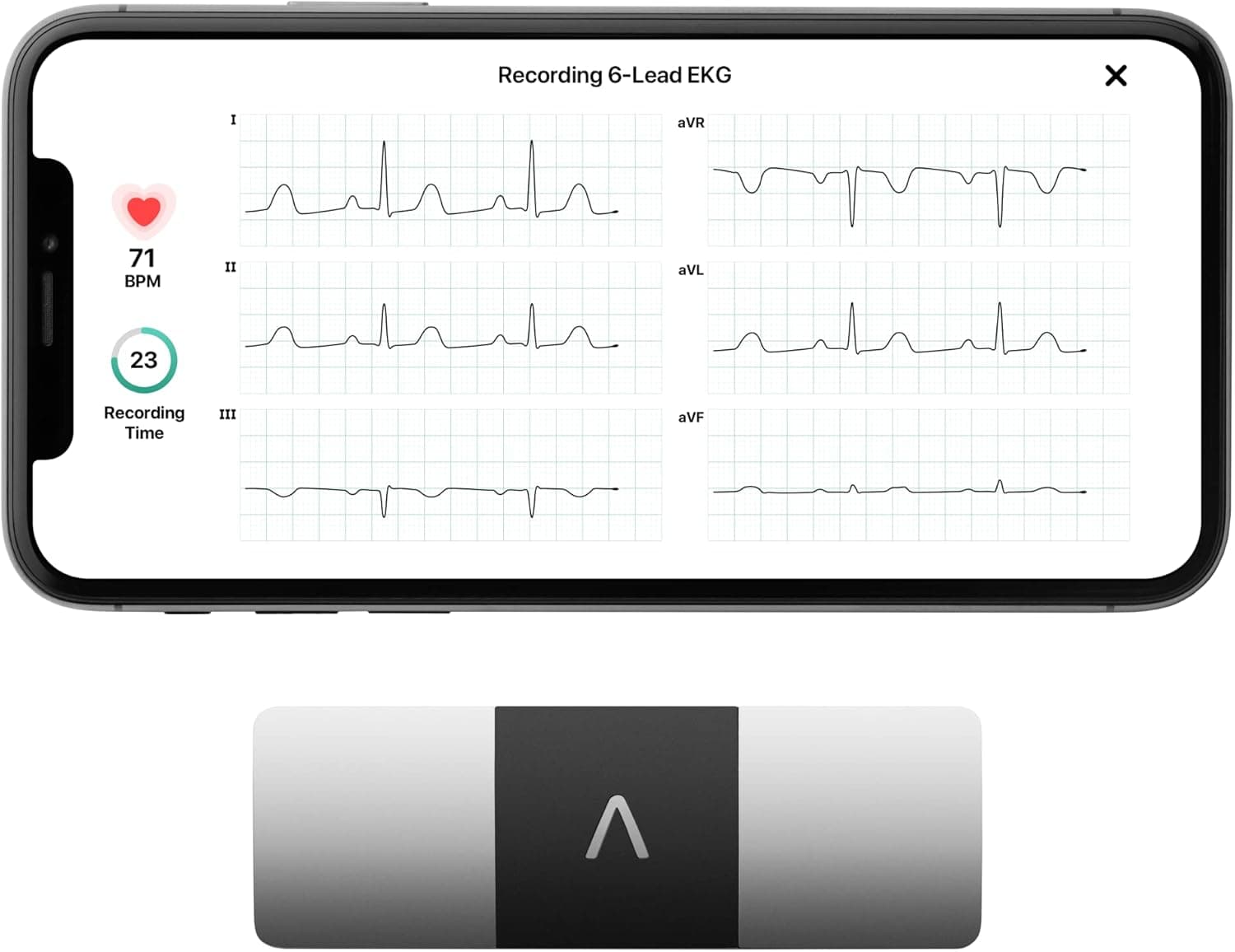 AliveCor KardiaMobile 6L