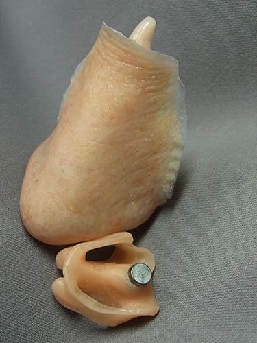 Custom Prosthetic Nose Solutions at Medical Art Prosthetics