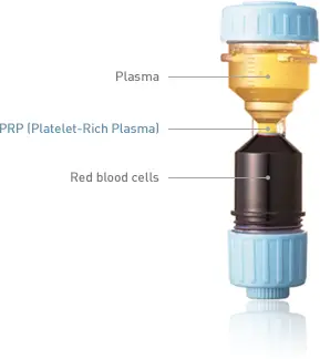 Platelet-Rich Plasma Kit | Dr. PRP USA