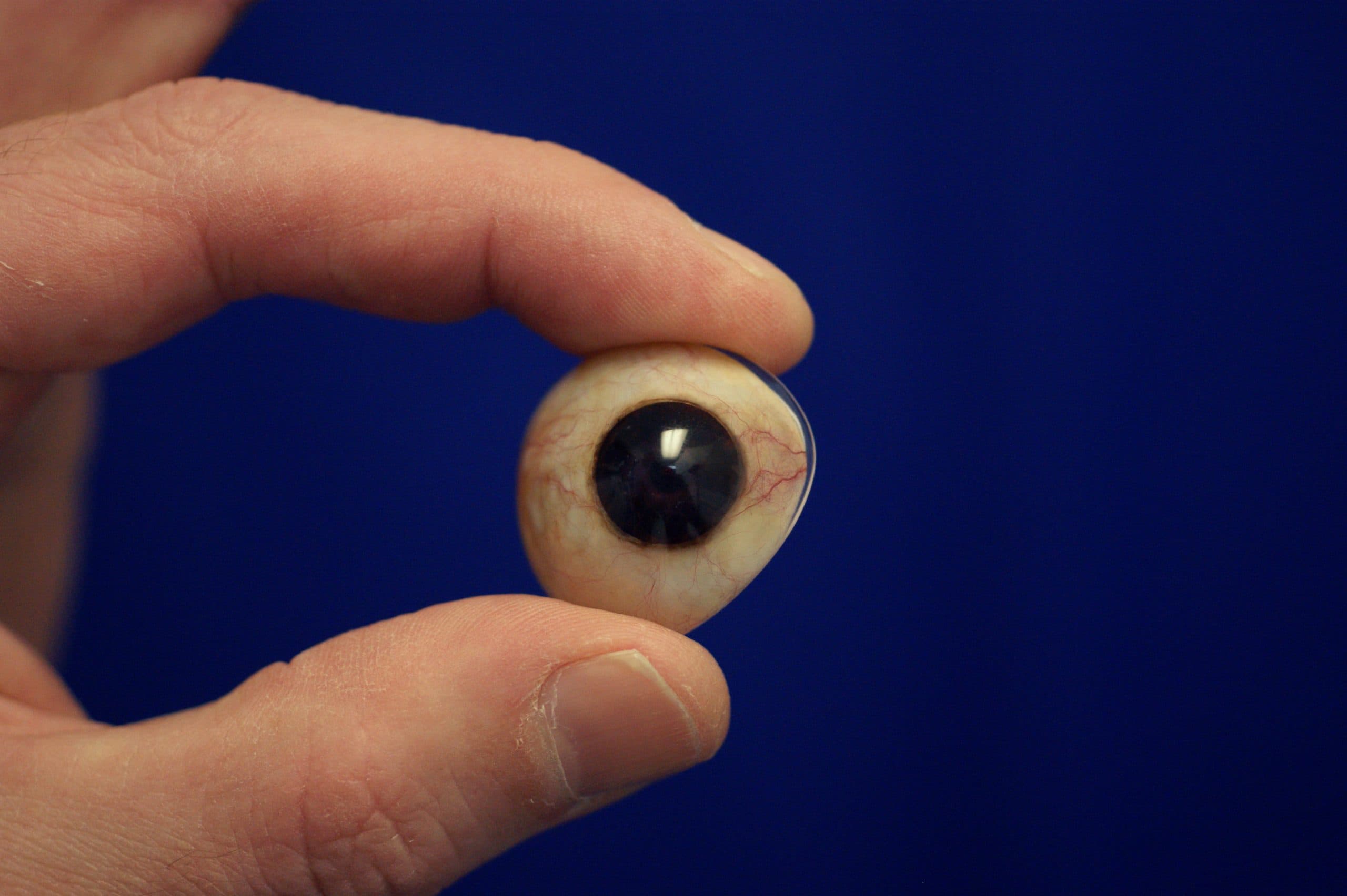 Ocular Prosthesis Eye Care - Ocular Prosthetics Internet Database ...