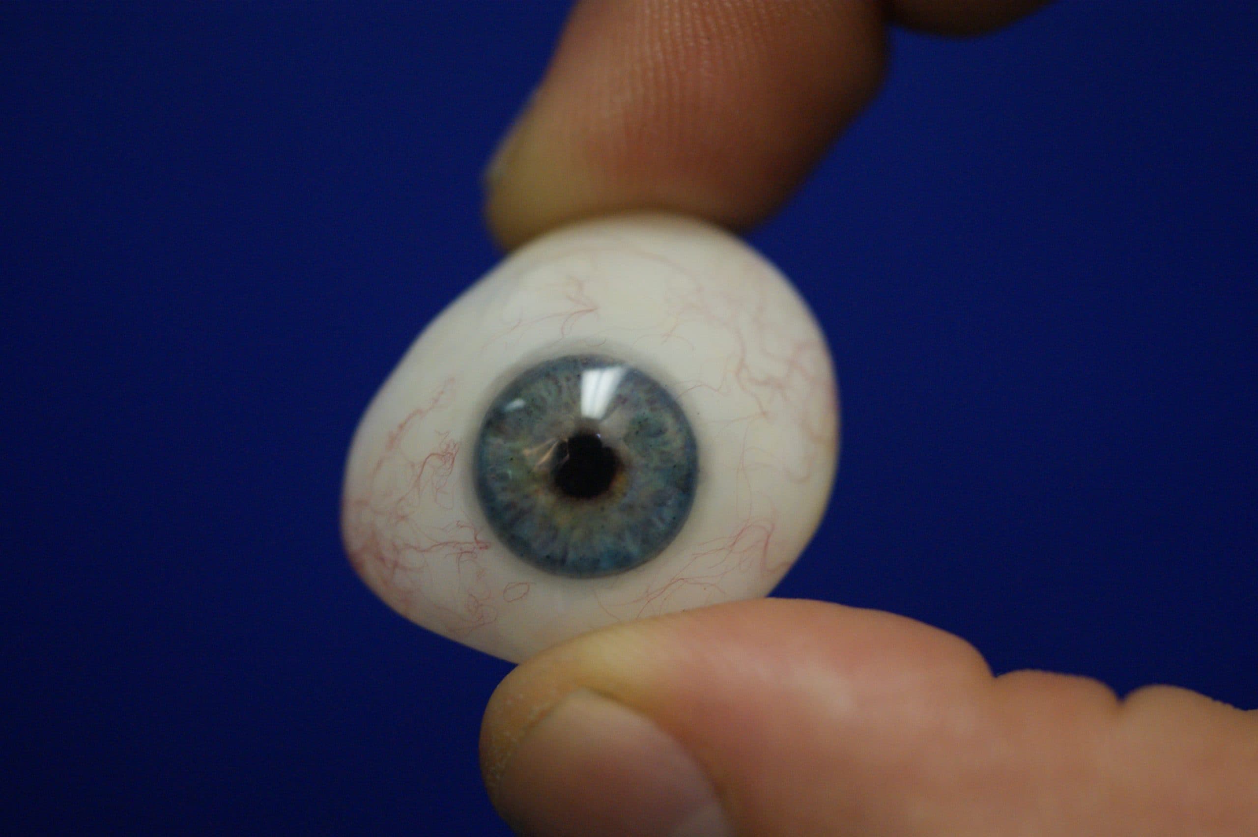 Ocular Prosthesis Eye Care - Ocularist Info, Ocular Prosthesis ...