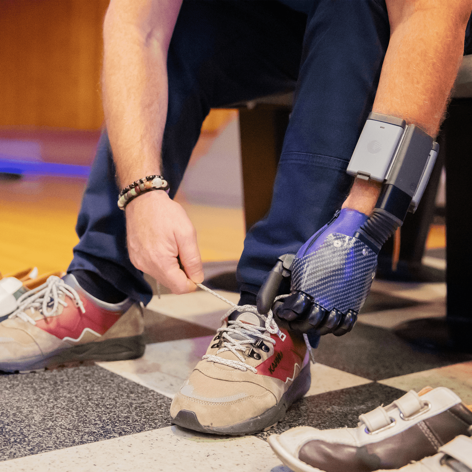 Partial Hand Prosthetics: An Overview - STEPS Prosthetics
