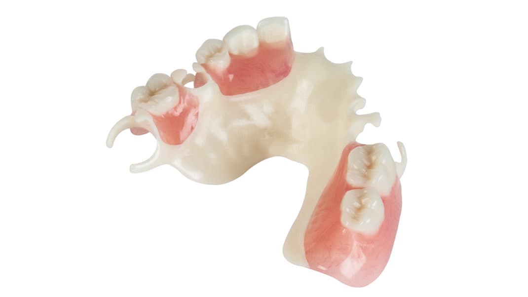 Zirlux Acetal - Metal-Free Removable Applications Made from Acetal Resin