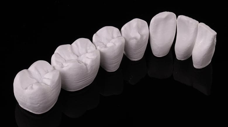 Prettau Anterior Zirconia Bridge (Zirkonzahn)