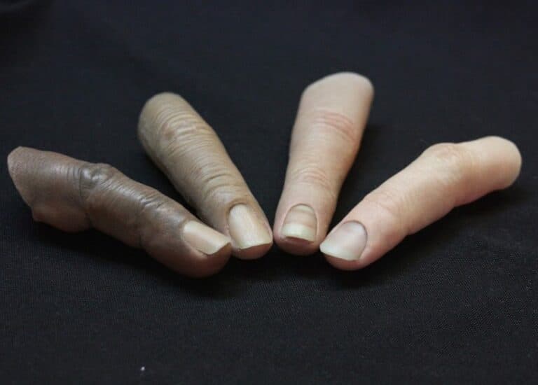 - Finger Prosthetics