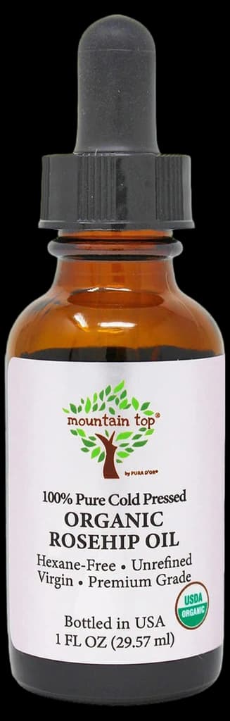 Amazon.com: MOUNTAIN TOP Rosehip Seed Oil USDA Organic 100% Pure Cold ...