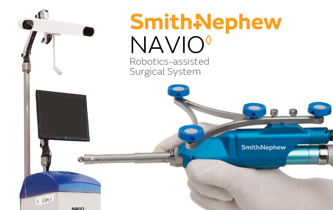 Navio Surgical System - Central Valley Hip and Knee | Dr Scott ...