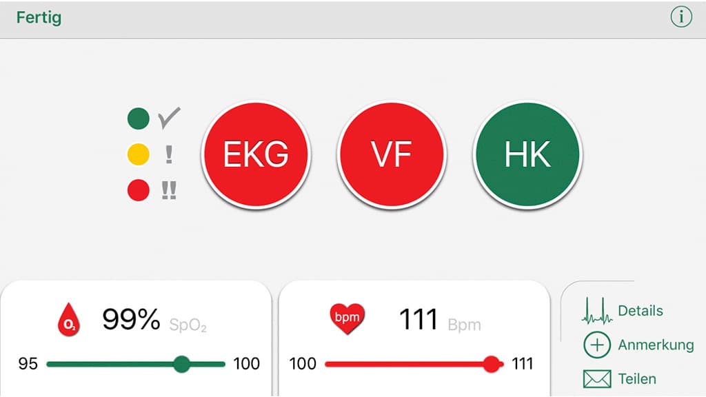 EKG-Gerät Sanatmetal Wiwe: Test, Preis - COMPUTER BILD