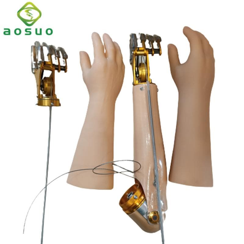 Myoelectric Prosthesis Arm Above The Elbow Myoelectric Prosthesis