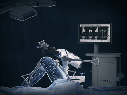 VELYS Robotic Assisted Solution | Johnson & Johnson Institute