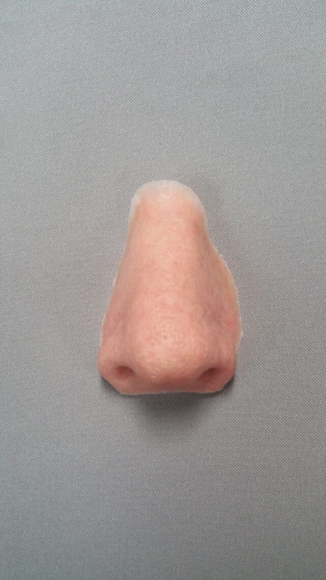 Custom Prosthetic Nose Solutions at Medical Art Prosthetics