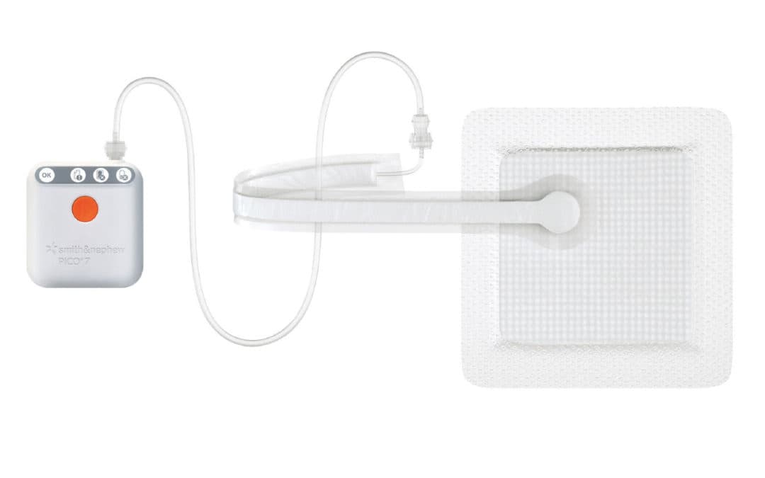 Smith+Nephew PICO Single Use Negative Pressure Wound Therapy | OR Today