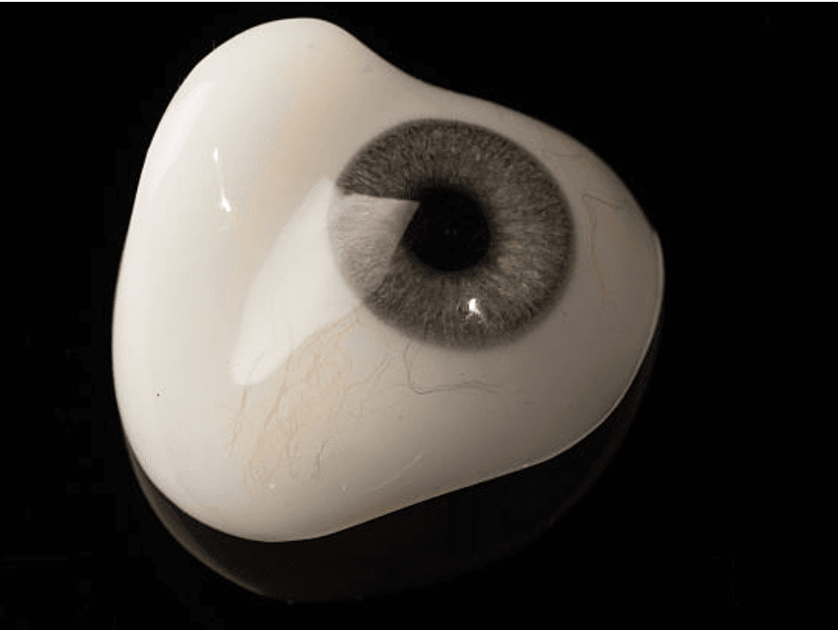 Custom Ocular Prosthetics in Essex | Expert Craftsmanship - South East ...