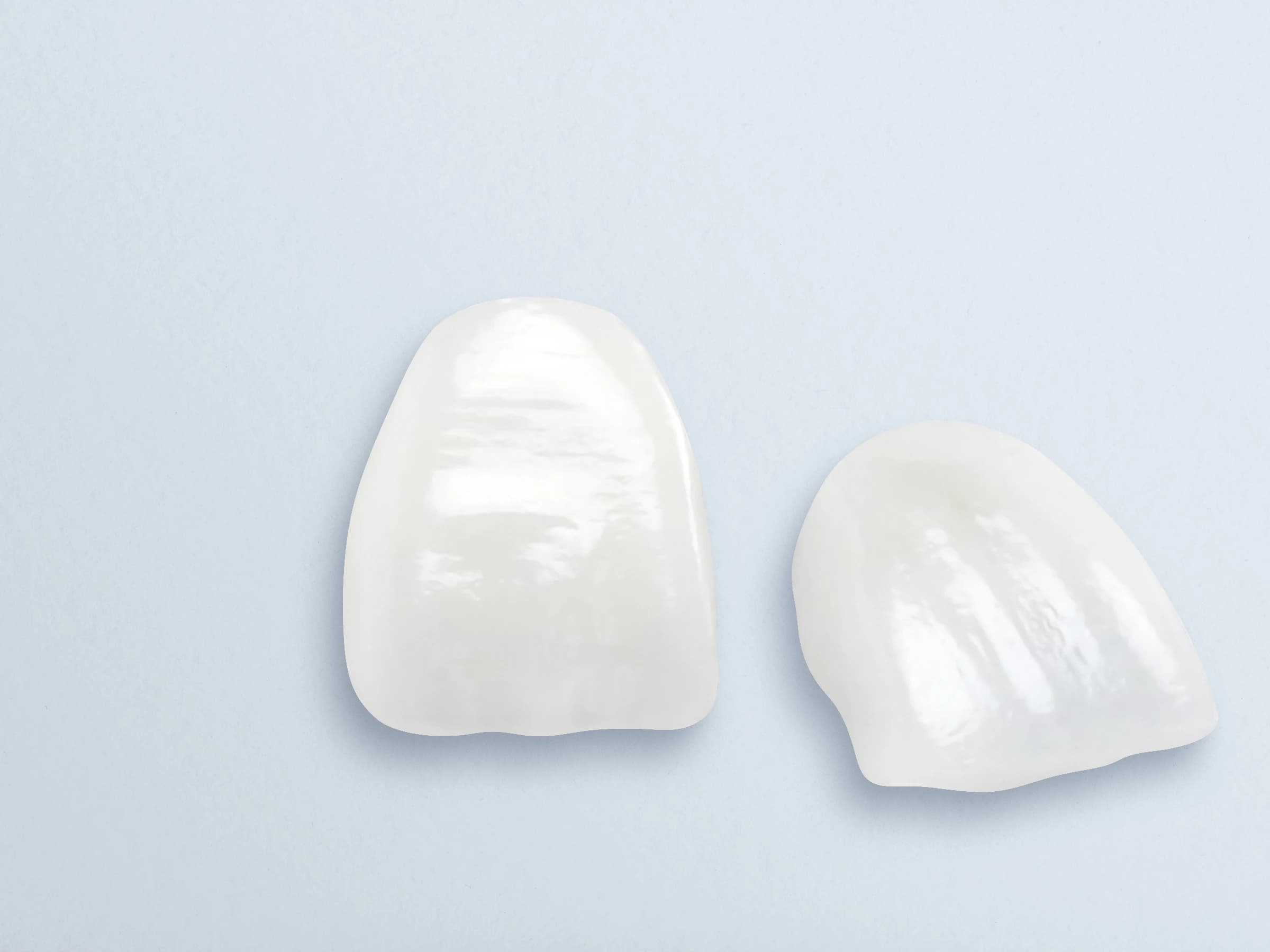 Lumineers® Dental Veneers - Smiles on Clark Dentistry in Orcutt, CA