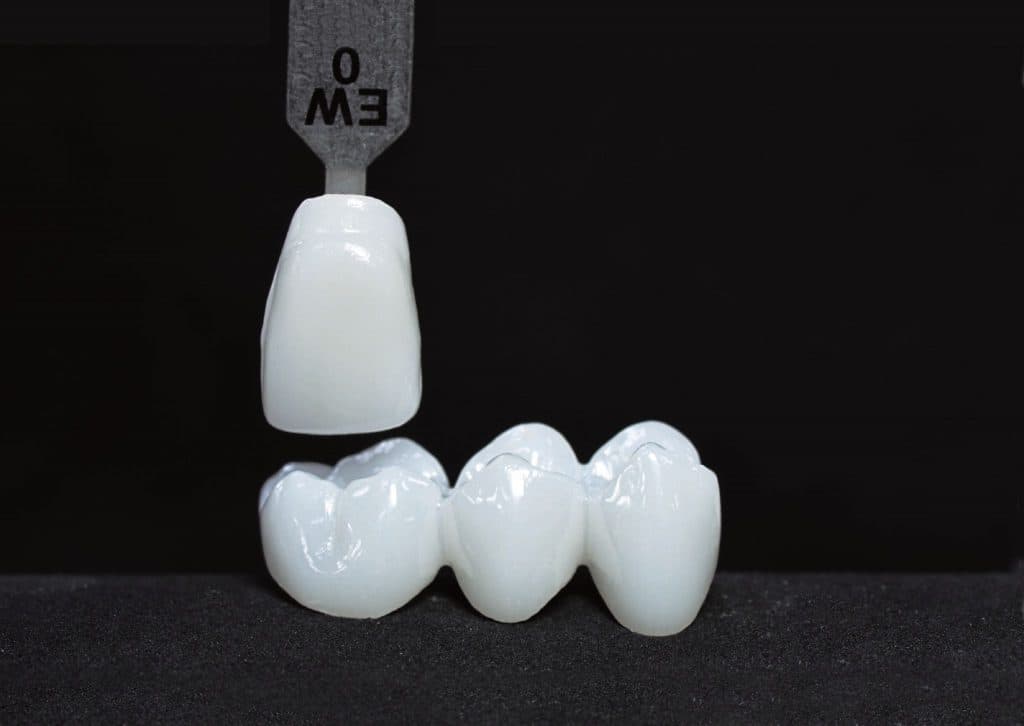 Katana™ UTML Anterior Zirconia Restorations - First Choice Dental Lab®