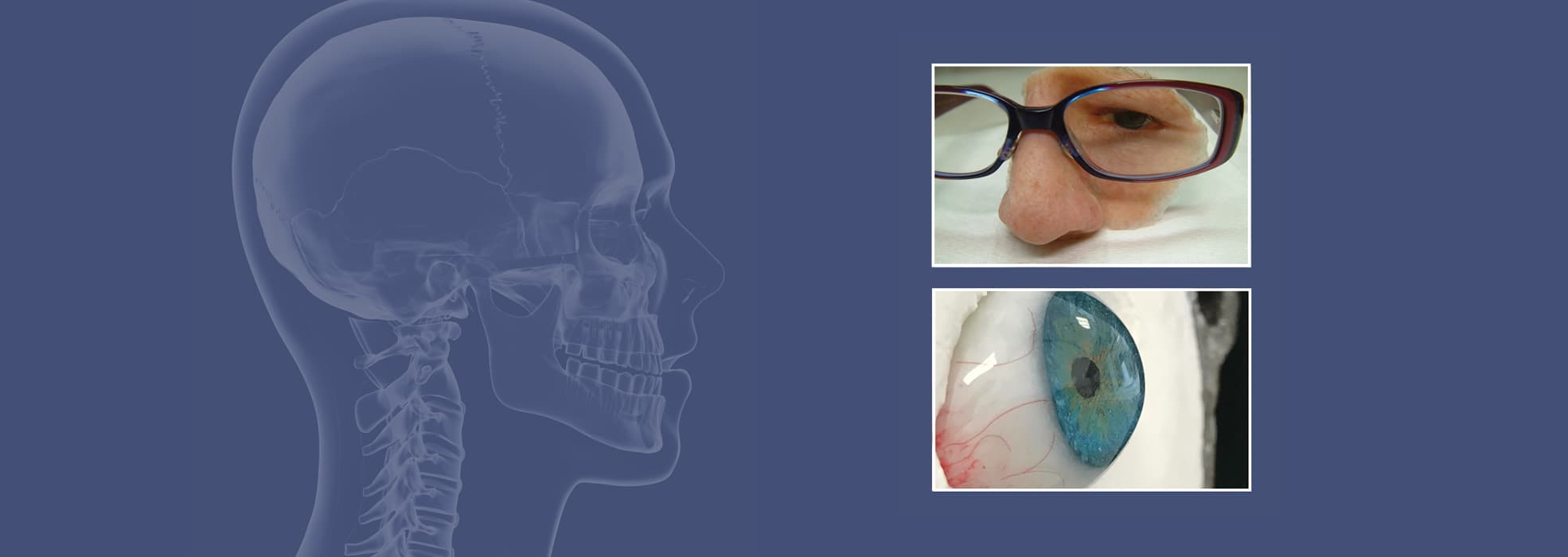 IMPT – The Institute of Maxillofacial Prosthetists and Technologists ...