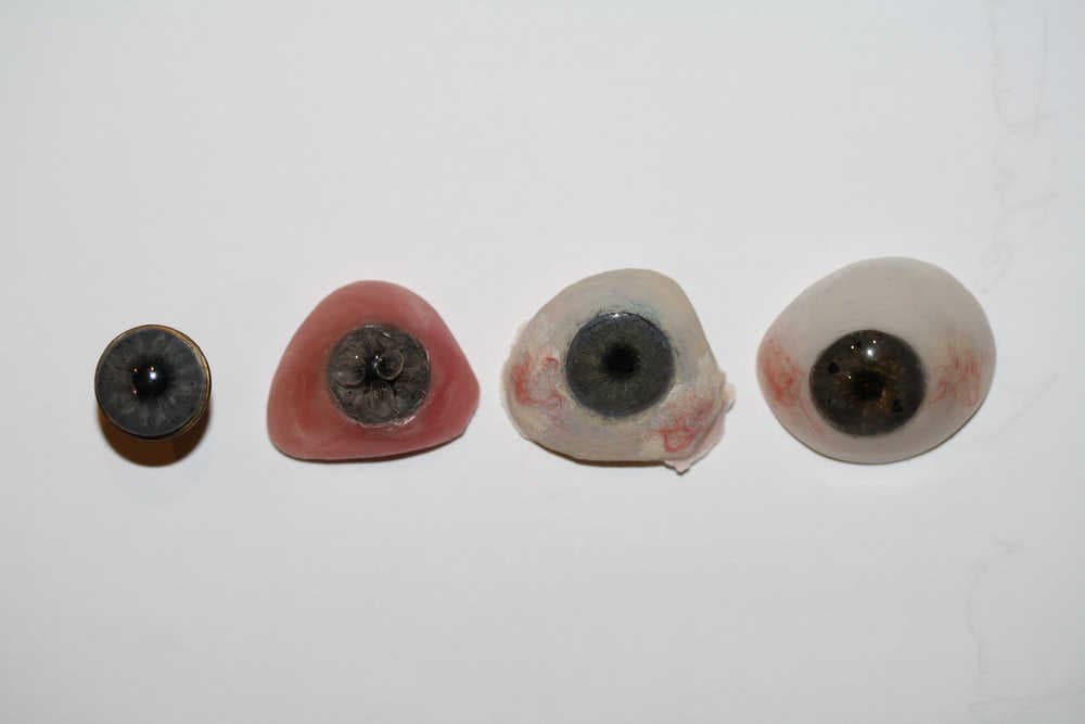 Prosthetic Eyes Specialists | Custom-Made Prosthetic Eyes NZ