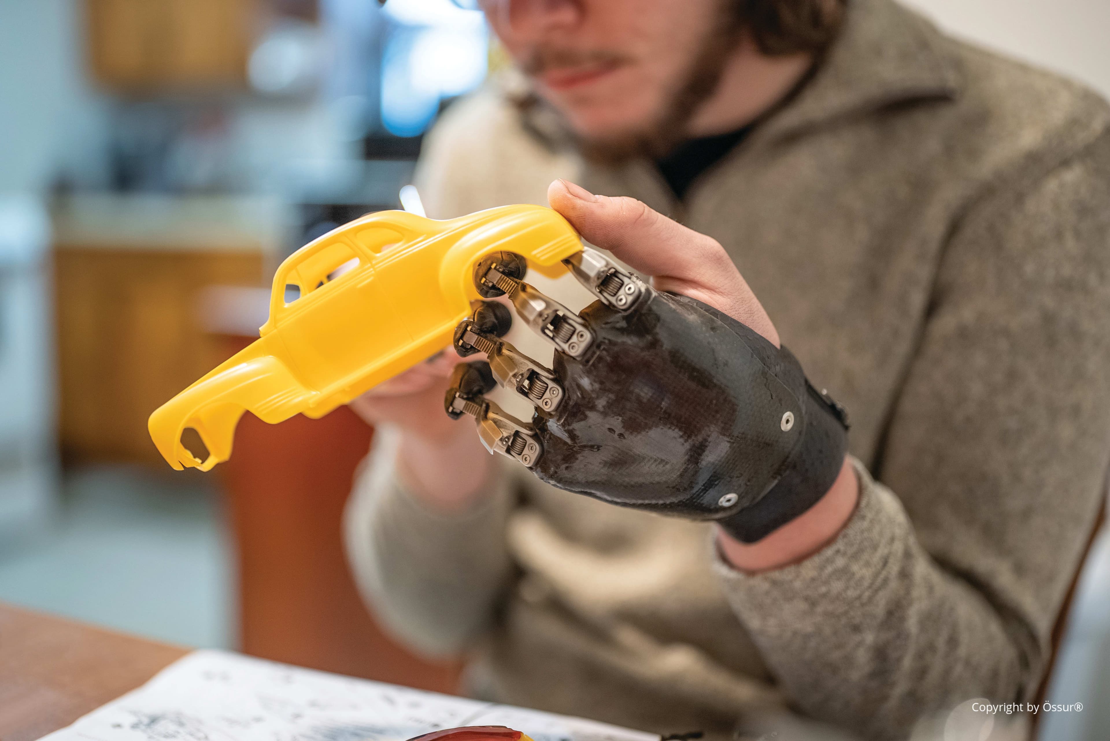 Naked Prosthetics | Funktionelle, langlebige & körperkraftgesteuerte ...