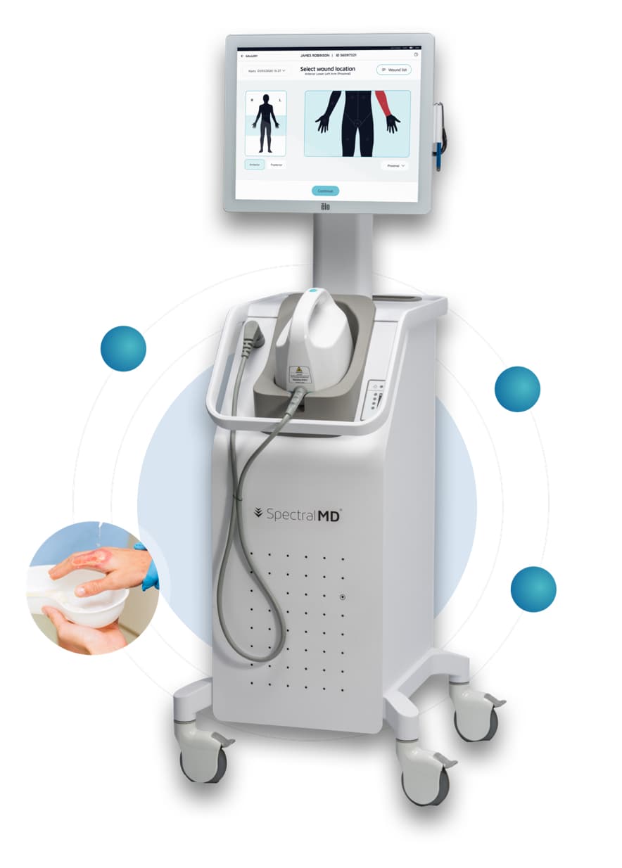 Spectral Medical AROYA Wound Imaging System