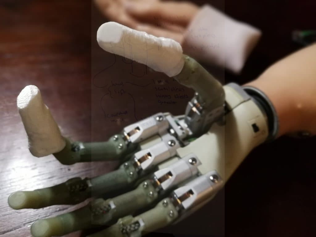 Touch Bionics iLimb – TECHNICAL RIGHT BELOW ELBOW AMPUTEE ISSUES